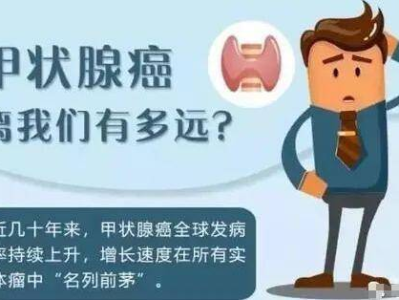 甲状腺癌高发趋势背后的原因探析